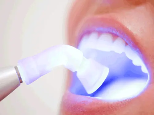 Soft Tissue Laser Treatments available at Maldonado Dentistry in Treasure Island, FL