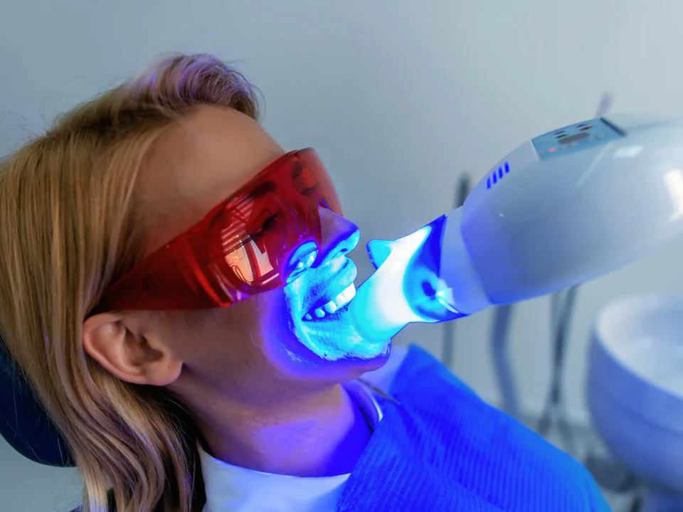 Teeth whitening services at Maldonado Dentistry in Treasure Island, Florida